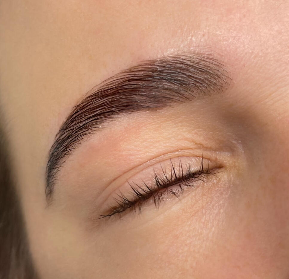 picture of brow lifting